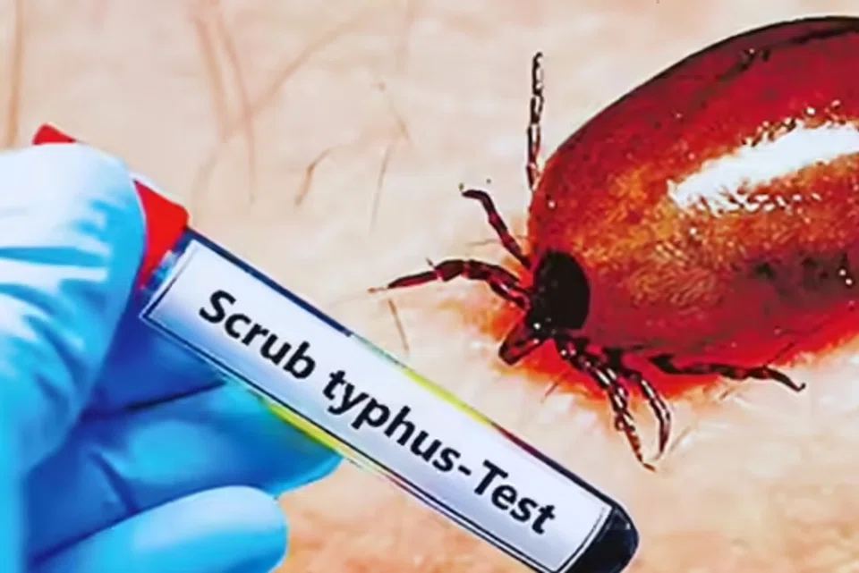 ஆந்திராவில் 1,592 பேருக்கு உண்ணிக் காய்ச்சல்; தமிழகத்திலும் பரவலாம்